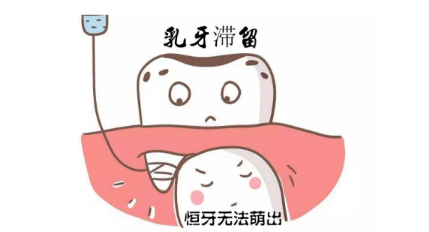 明明乳牙很整齐，为什么恒牙就歪了呢？